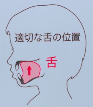 正しい舌の位置 藤沢駅徒歩5分 イーライズ こども歯科 矯正クリニック